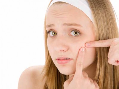 Eliminar el acné de forma natural
