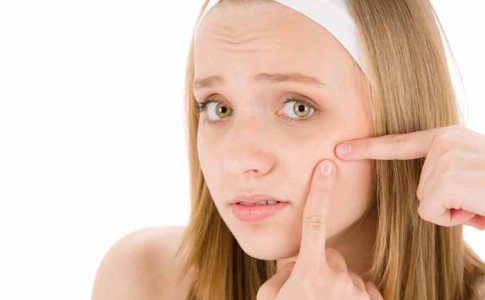 Eliminar el acné de forma natural
