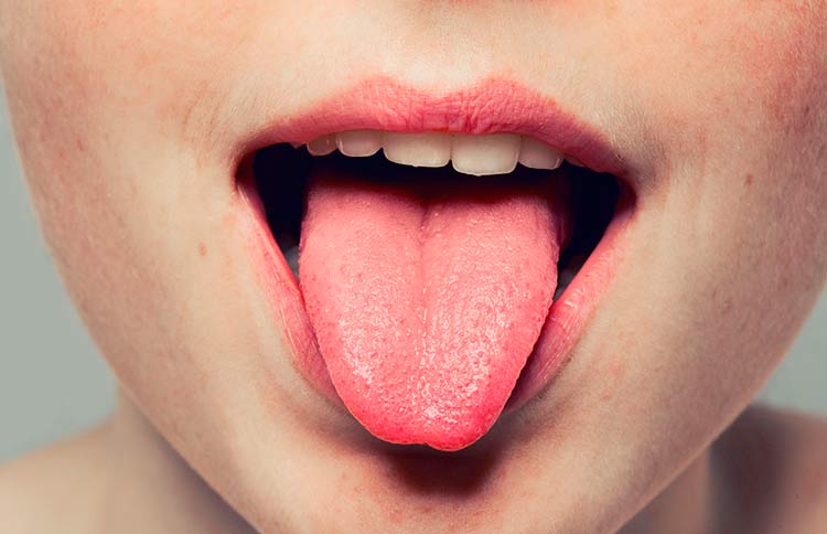 remedios naturales para la lengua blanca