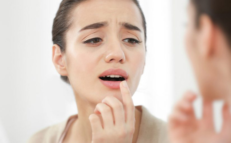 herpes en los labios remedios caseros